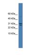 Serine Peptidase Inhibitor, Kunitz Type 2 antibody, orb331022, Biorbyt, Western Blot image 
