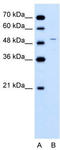 Ferrochelatase, mitochondrial antibody, TA346251, Origene, Western Blot image 