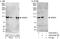WW Domain Containing E3 Ubiquitin Protein Ligase 2 antibody, A302-935A, Bethyl Labs, Immunoprecipitation image 