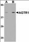 Solute Carrier Family 33 Member 1 antibody, orb89841, Biorbyt, Western Blot image 