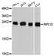 Ribosomal Protein L10 antibody, STJ111620, St John