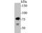 Spermatogenesis Associated 5 Like 1 antibody, NBP2-80413, Novus Biologicals, Western Blot image 