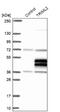 Tripartite Motif Family Like 2 antibody, NBP1-92531, Novus Biologicals, Western Blot image 