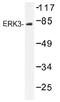 SMAD Family Member 3 antibody, AP01454PU-N, Origene, Western Blot image 