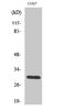 Holocytochrome C Synthase antibody, STJ93472, St John