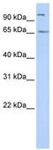 Spermatogenesis Associated 16 antibody, TA344246, Origene, Western Blot image 