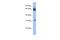 Chromosome 11 Open Reading Frame 54 antibody, A13218, Boster Biological Technology, Western Blot image 