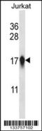 Histone H3-like centromeric protein A antibody, 57-304, ProSci, Western Blot image 