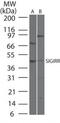 Single Ig And TIR Domain Containing antibody, PA1-41384, Invitrogen Antibodies, Western Blot image 