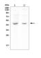Mannose Phosphate Isomerase antibody, M00175, Boster Biological Technology, Western Blot image 