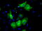 SDH antibody, TA500702, Origene, Immunofluorescence image 