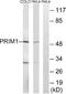DNA Primase Subunit 1 antibody, A30648, Boster Biological Technology, Western Blot image 