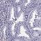 MAGE Family Member B2 antibody, HPA074544, Atlas Antibodies, Immunohistochemistry paraffin image 
