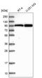 A-Kinase Anchoring Protein 8 Like antibody, HPA042485, Atlas Antibodies, Western Blot image 