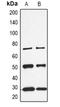 Calbindin 1 antibody, orb339116, Biorbyt, Western Blot image 