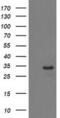 Haloacid Dehalogenase Like Hydrolase Domain Containing 2 antibody, MA5-25532, Invitrogen Antibodies, Western Blot image 