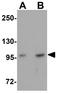 FRAS1 Related Extracellular Matrix 2 antibody, GTX85004, GeneTex, Western Blot image 