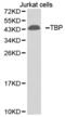 TATA-Box Binding Protein antibody, abx001804, Abbexa, Western Blot image 