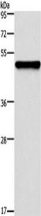 Keratin 14 antibody, TA323634, Origene, Western Blot image 