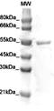 Desmin antibody, TA354681, Origene, Western Blot image 