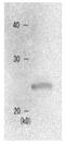 Chromobox 1 antibody, GTX00736, GeneTex, Western Blot image 