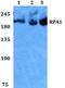Replication Protein A1 antibody, A01317, Boster Biological Technology, Western Blot image 