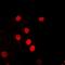 Replication Protein A2 antibody, orb315689, Biorbyt, Immunofluorescence image 