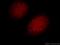 Ubiquitin Interaction Motif Containing 1 antibody, 13642-1-AP, Proteintech Group, Immunofluorescence image 