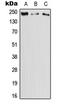 Dedicator Of Cytokinesis 11 antibody, LS-C353629, Lifespan Biosciences, Western Blot image 