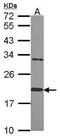 MAF BZIP Transcription Factor G antibody, PA5-30086, Invitrogen Antibodies, Western Blot image 