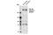 Sodium Voltage-Gated Channel Alpha Subunit 10 antibody, 14380S, Cell Signaling Technology, Western Blot image 