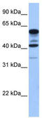 Terminal Nucleotidyltransferase 5C antibody, TA335539, Origene, Western Blot image 