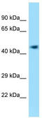 EF-Hand Calcium Binding Domain 14 antibody, TA341957, Origene, Western Blot image 
