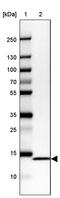 NADH:Ubiquinone Oxidoreductase Subunit C2 antibody, PA5-58572, Invitrogen Antibodies, Western Blot image 