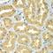 Golgi-associated PDZ and coiled-coil motif-containing protein antibody, LS-C748486, Lifespan Biosciences, Immunohistochemistry paraffin image 