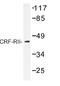 Corticotropin Releasing Hormone Receptor 2 antibody, AP01213PU-N, Origene, Western Blot image 