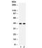 Sarcoglycan Alpha antibody, R32245, NSJ Bioreagents, Western Blot image 