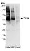 Solute Carrier Family 39 Member 14 antibody, A304-479A, Bethyl Labs, Western Blot image 