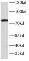 Sodium-dependent serotonin transporter antibody, FNab10277, FineTest, Western Blot image 