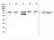 Proprotein Convertase Subtilisin/Kexin Type 9 antibody, A00085-1, Boster Biological Technology, Western Blot image 