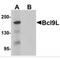 BCL9 Like antibody, MBS150978, MyBioSource, Western Blot image 