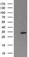 Retinoic Acid Receptor Responder 1 antibody, TA506091BM, Origene, Western Blot image 