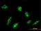 Origin Recognition Complex Subunit 4 antibody, LS-C197825, Lifespan Biosciences, Immunofluorescence image 