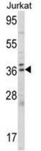 Aminolevulinate Dehydratase antibody, GTX81701, GeneTex, Western Blot image 