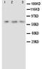 Angiopoietin 2 antibody, PA1005, Boster Biological Technology, Western Blot image 