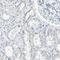 Serine/threonine-protein kinase LMTK1 antibody, HPA009073, Atlas Antibodies, Immunohistochemistry frozen image 