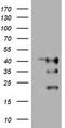 Transmembrane Protein 173 antibody, TA505015, Origene, Western Blot image 