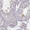 Spermatogenesis Associated 32 antibody, NBP1-93913, Novus Biologicals, Immunohistochemistry paraffin image 