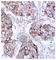 EGFR antibody, AP0154, ABclonal Technology, Immunohistochemistry paraffin image 