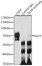 Alkaline Phosphatase, Placental antibody, GTX33413, GeneTex, Immunoprecipitation image 